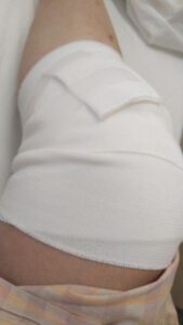 膝関節拘縮で授動術とリハビリ。そして1週間の入院生活(3日目)